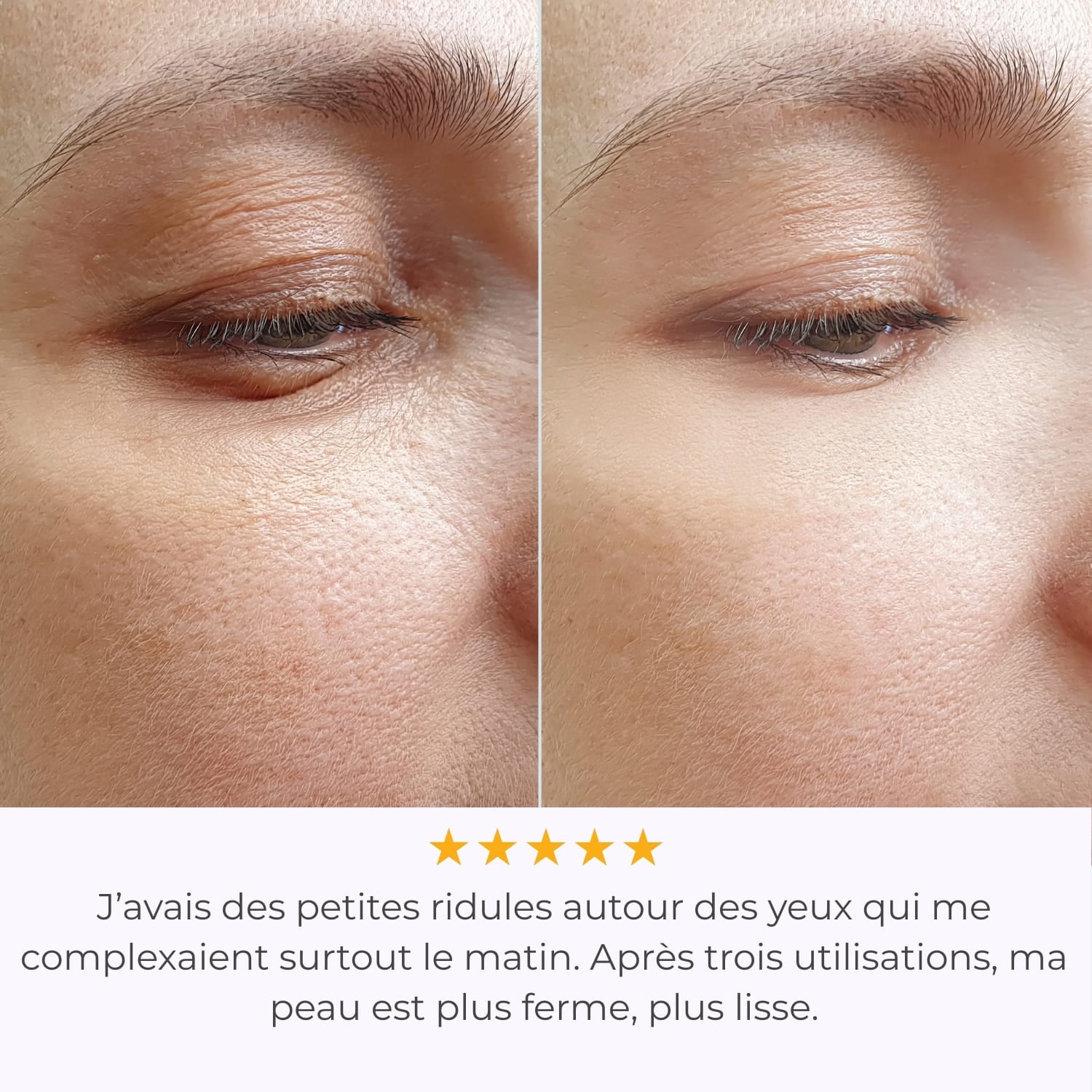 Système de Micro-Infusion - Glove