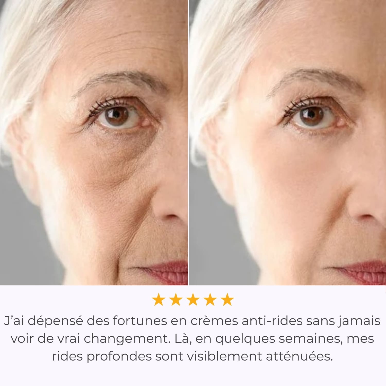 Système de Micro-Infusion - Glove