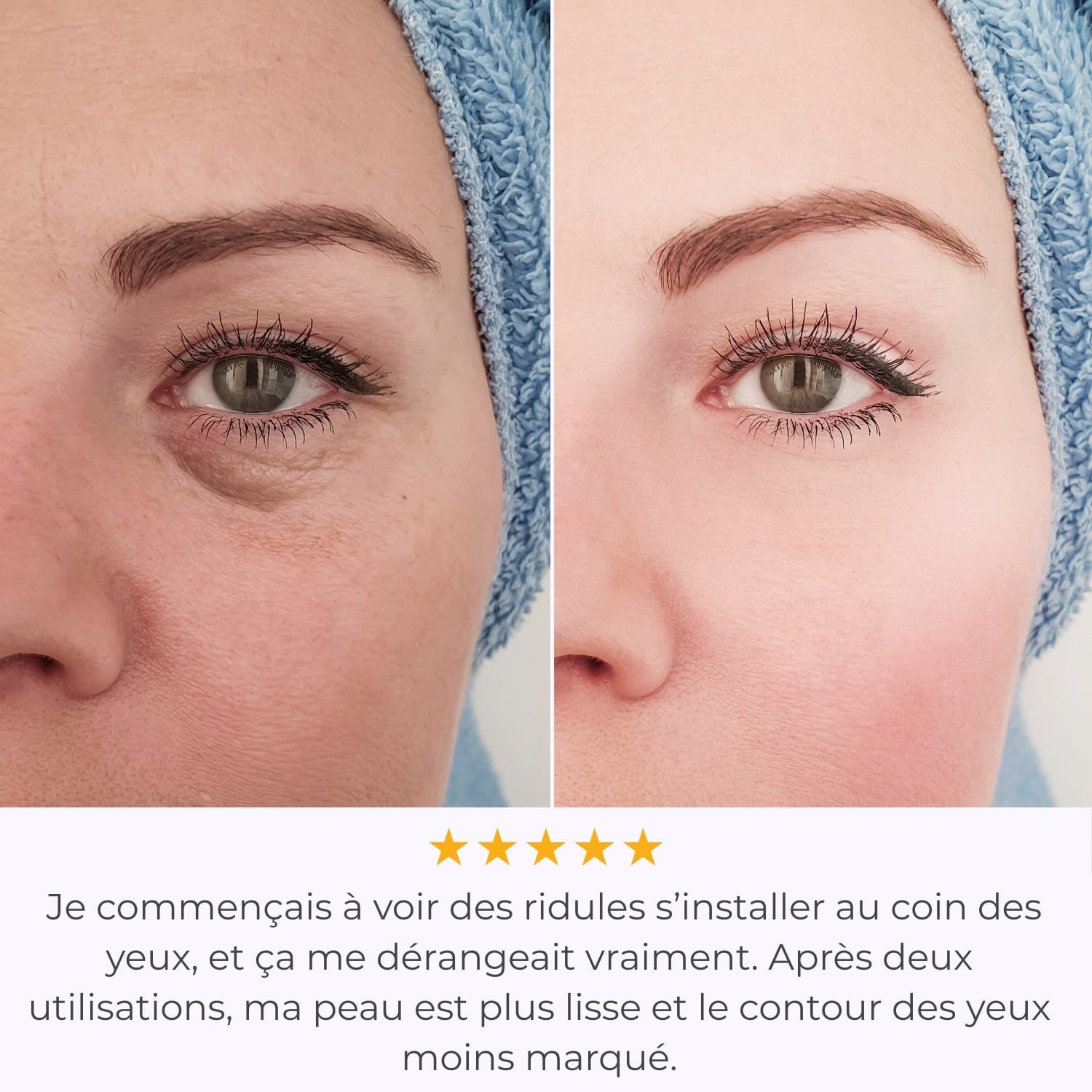 Système de Micro-Infusion - Glove