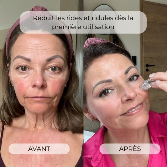 Système de Micro-Infusion - Glove